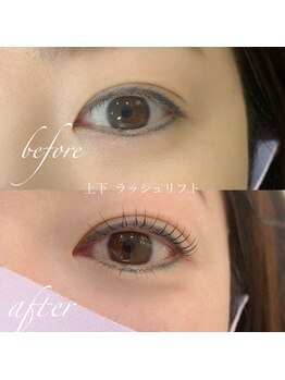 リルベアー(LIL BEAR)/上下ラッシュリフト