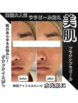 リノミラ(LINOMIRA)/長年の悩み肌お任せください