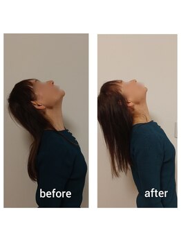 エム(M)/整体 可動域UP