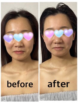 グッドライフペイ(Good Life Pay)/小顔フェイシャルの効果