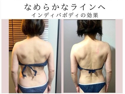 ワン ストレッチ(ONE stretch)の写真