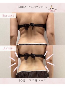 スーペリオル(Superior)/お腹周りのむくみスッキリ!