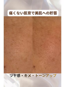 マウム(Maum)/肌育で美肌への貯蓄