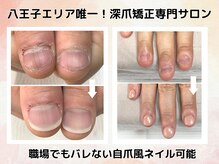 エルナ(elna)の雰囲気（症例実績５万件以上の八王子エリア初のリプロネイル登録店！）