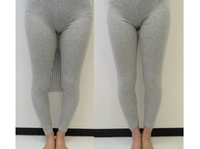 川西アクシス整体院(川西AXIS整体院)/O脚改善