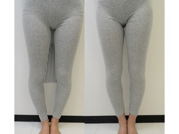 川西アクシス整体院(川西AXIS整体院)/O脚改善