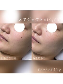 パリスエリー(PARIS ELLY)/メタジェクト☆