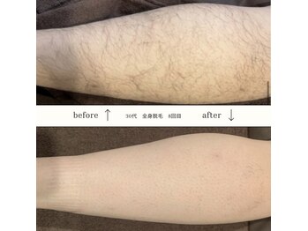 モア男子(MORE男子)/清潔感アップ