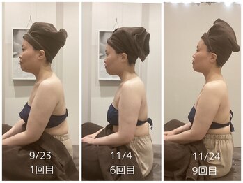 千歳の女神 刈谷店/Before/After