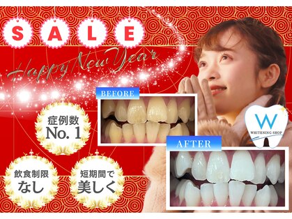 ホワイトニングショップ 葛西店の写真