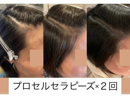 【プロセルセラピーズ認定店 plage】毛穴ケア/育毛/更年期/デトックスの写真