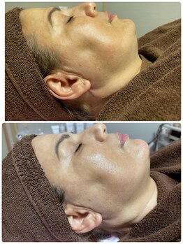 エーエフビューティーエステ(AF Beauty Esthetic)/50代肌質改善フェイシャル
