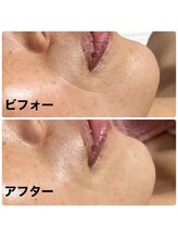 アンヘル(Angel)/リアボーテグランタラソ