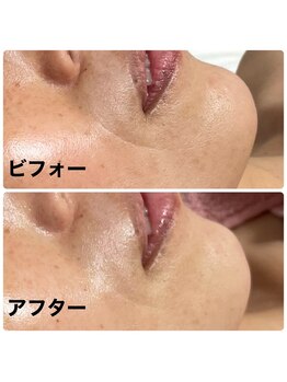 アンヘル(Angel)/リアボーテグランタラソ