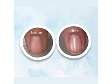 シュアム(shuam)/【自爪育成】自爪風/深爪卒業