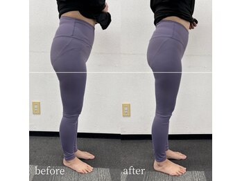 ベレミアム(Bellemium)/骨盤ケアで下半身痩せ