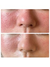 リノリー(rinory)/肌改善はお任せください