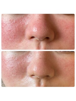 リノリー(rinory)/肌改善はお任せください