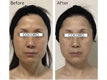 ココロ(COCORO)/輪郭スッキリ◎