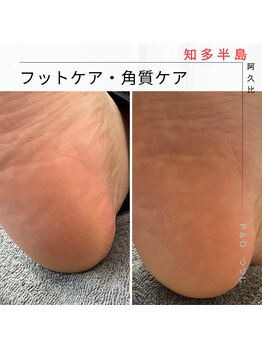 ピーアンドオー(P&O)/