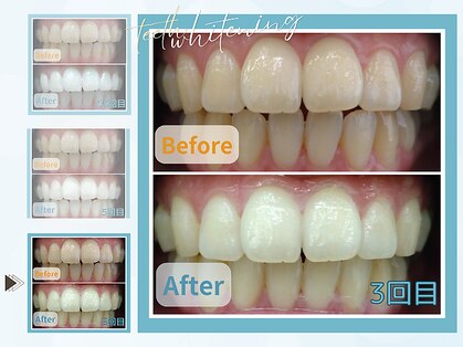 グロウ グロウ(grow.glow)の写真