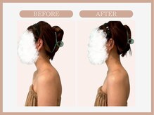 アコガレコガオ 山形店/