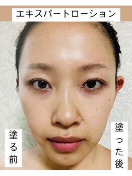 リル(Lil)/エキスパートローションの実力！