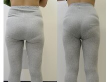 川西アクシス整体院(川西AXIS整体院)/骨盤周辺の引き締め