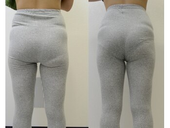 川西アクシス整体院(川西AXIS整体院)/骨盤周辺の引き締め