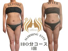 ビハーラ 門司店/3ヶ月で結果出し痩身リンパ/門司