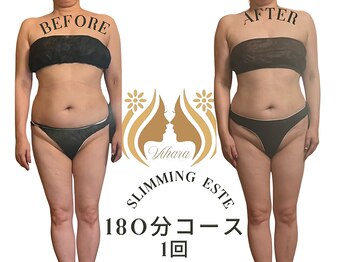 ビハーラ 門司店/3ヶ月で結果出し痩身リンパ/門司