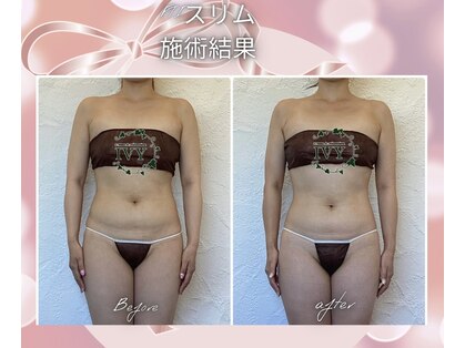 アイビー 大形店(IVY)の写真