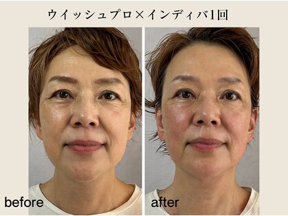 ウィッシュプロサロンケー(Wishpro salon K)の写真