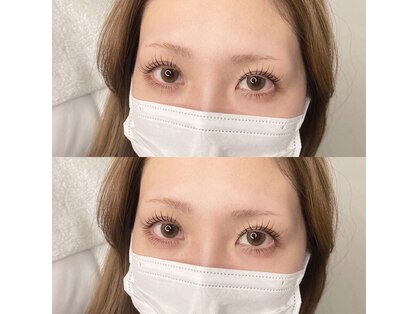 イチ(ichi)の写真