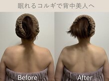 セレソル(CERESOL)/〈40代〉一度で背中美人も可能♪