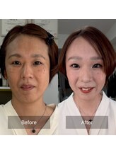 ハッピーアリスター(HAPPY ALISTER)/似合わせメイクビフォーアフター