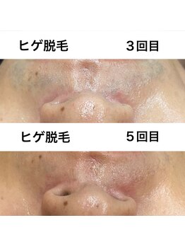 ピュアトゥルー 岐阜西店(PureTrue)/実感が早い！！