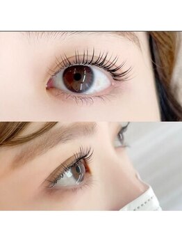 ルシア 大宮店(Lucea)/まぶたからリフトアップ効果◎