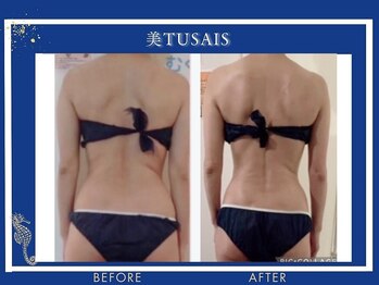 ビテュセ(美Tu sais)/【痩身・ダイエット】ボディケア