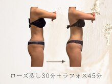 アネラボーテ(Anela Beaute)/ローズ蒸し＋ラフォスボディ