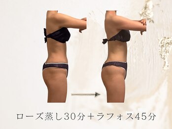 アネラボーテ(Anela Beaute)/ローズ蒸し＋ラフォスボディ