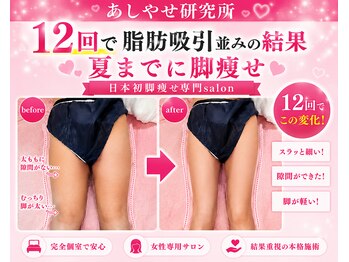 メディカルエステ 大宮店の写真/あしやせ研究所独自の開発メゾット◎業界唯一4つの機能を搭載◎痩身医療¥5300★レモンボトル¥2480★