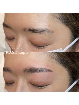 フレイズラピス(FRASE Lapis)/【ハリウッドブロウリフト】