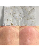 ジュメイラ(Jumeirah)/二刀流エクストラクション！