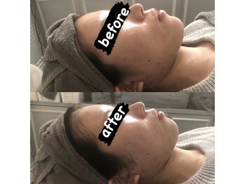 ディライト 名古屋駅店(Delight)/食いしばりケア