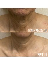 コリー(Kolly)/首も見られてる！？