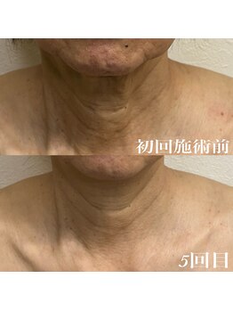 コリー(Kolly)/首も見られてる！？