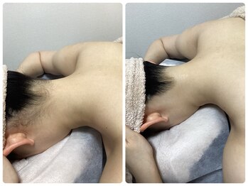 ルルトウキョウ 池袋店(LULU.tokyo)/うなじ脱毛