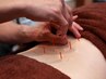 定期メンテナンス：１ヶ月以内継続割【鍼灸施術】