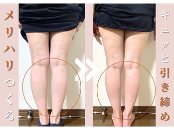 ヨサパーク エム(YOSA PARK 笑)/効果事例